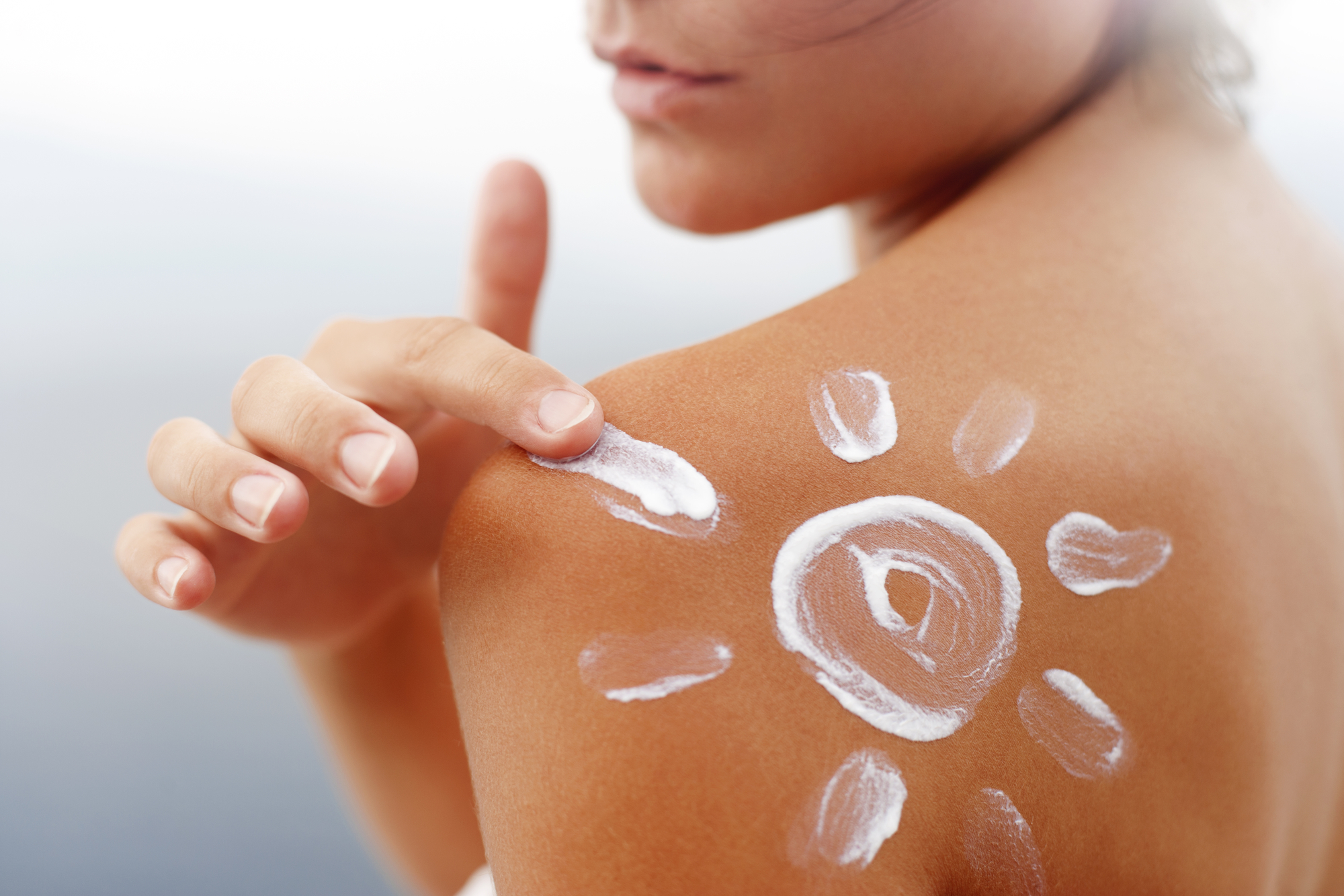 How to treat sunburn this summer and avoid it for the future