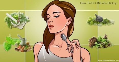3 Best Remedies to Get Rid of Hickey Fast